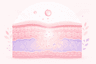 Botox