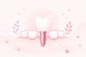 implantes