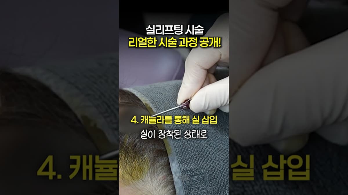 실리프팅 시술, 리얼한 시술 과정 공개!    #실리프팅 #실리프팅효과
