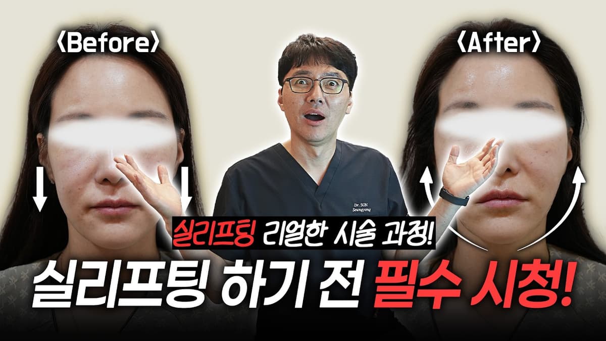 울쎄라, 써마지 효과 없다고? 실리프팅 하기 전 필수 시청✨ 리얼한 시술 과정, 시술 전후 공개!💉   #실리프팅 #실리프팅후기