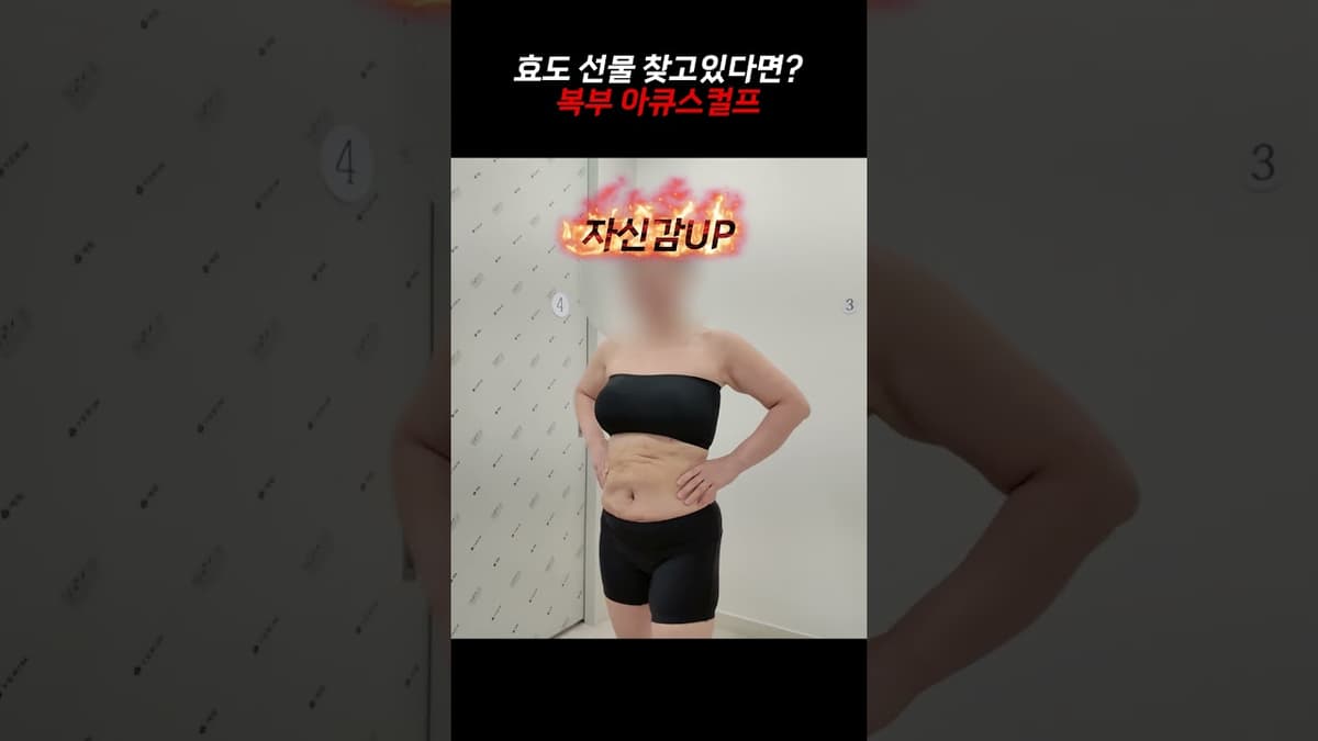 효도 선물 찾고 계신가요? 폐경 후 복부 아큐스컬프 전후 공개