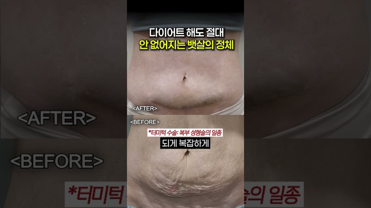 다이어트 해도 절대 안 없어지는 뱃살의 정체..