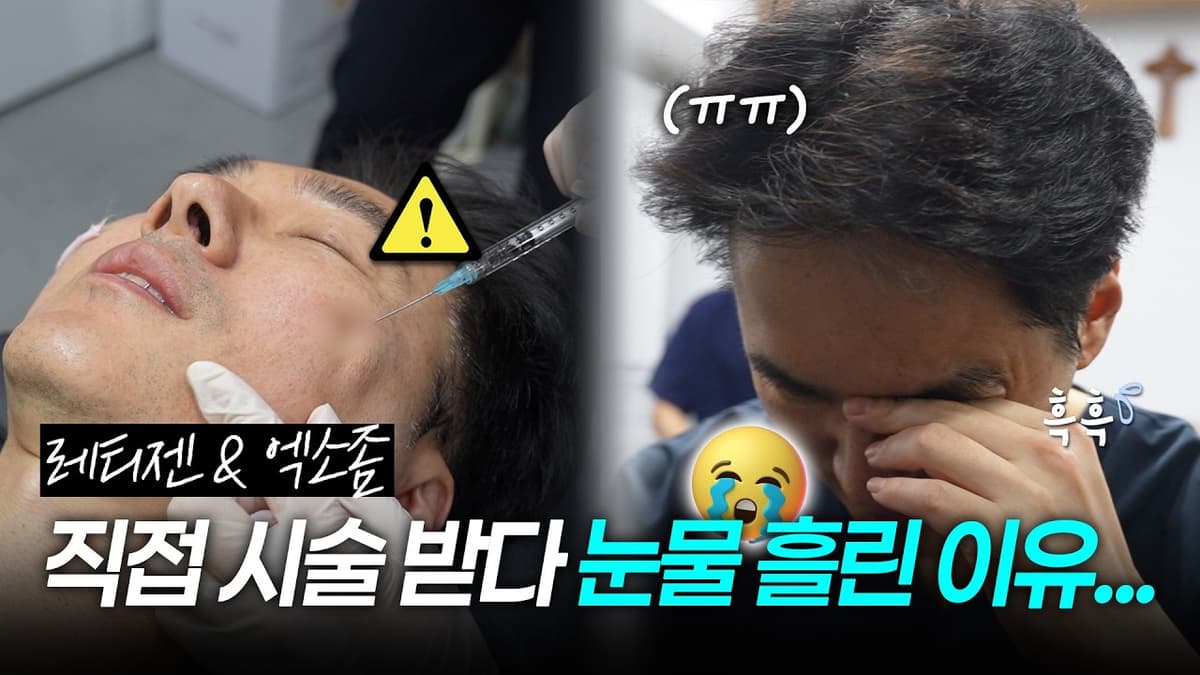 레티젠 & 엑소좀 직접 시술 받다가 눈물바다 된 진짜 이유...😢💦 리얼한 시술 과정 / 통증 정도 / 솔직 후기까지!✨️    #엑소좀 #스킨부스터