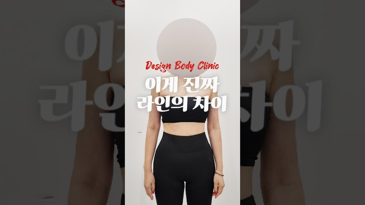 รีวิวดูดไขมันทั่วร่างกาย | หน้าท้อง 360 องศา แขน ต้นขา และการปลูกถ่ายไขมัน ครั้งที่ 2