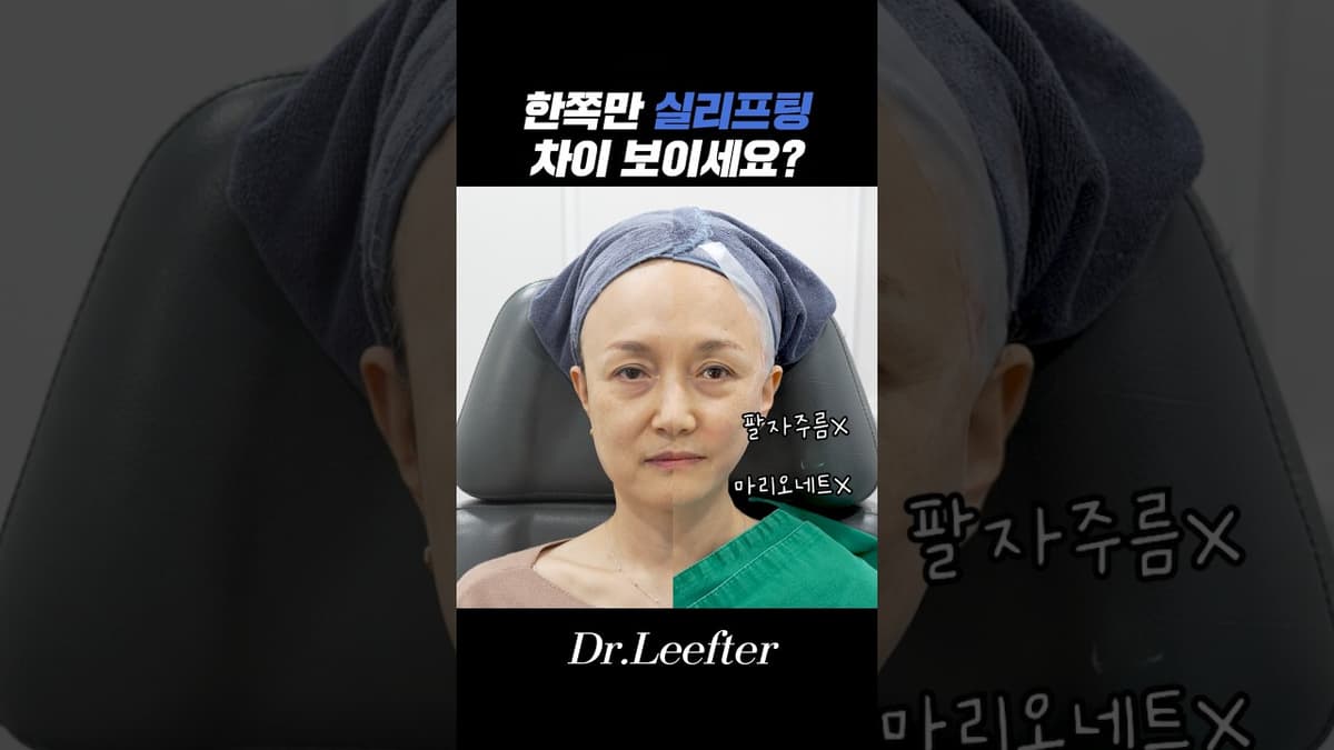 提線拉皮前後，有看到差別嗎？ #提線拉皮 #法令紋 #皮膚科