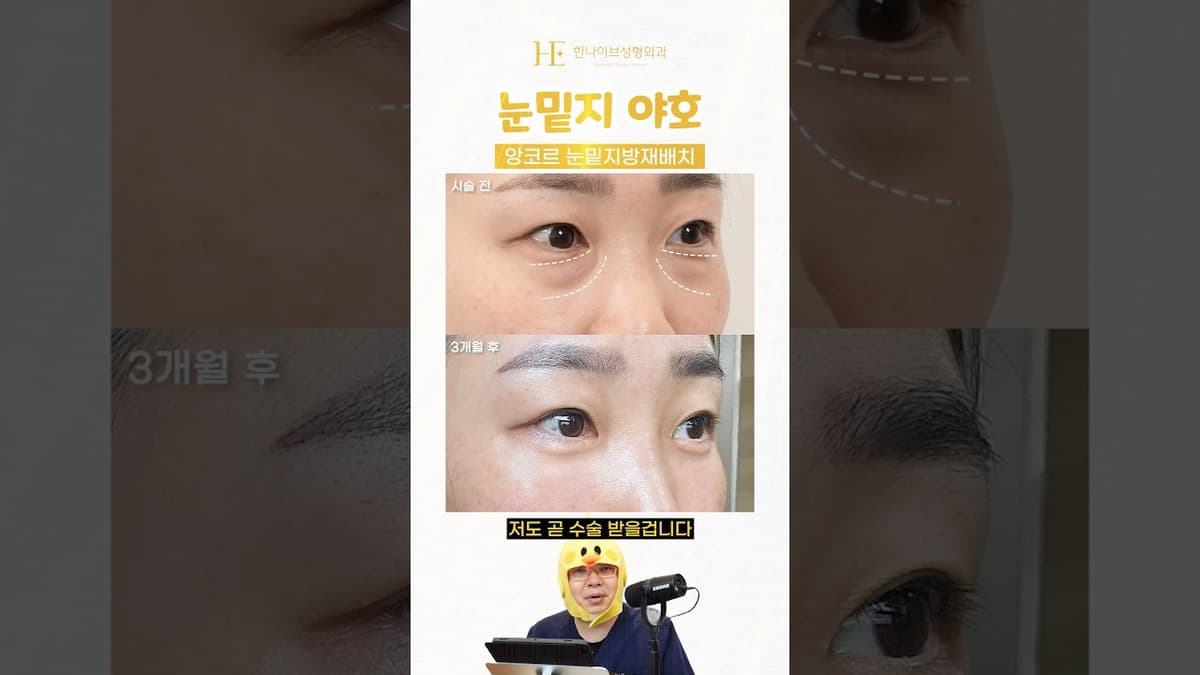 앙코르눈밑지 야호