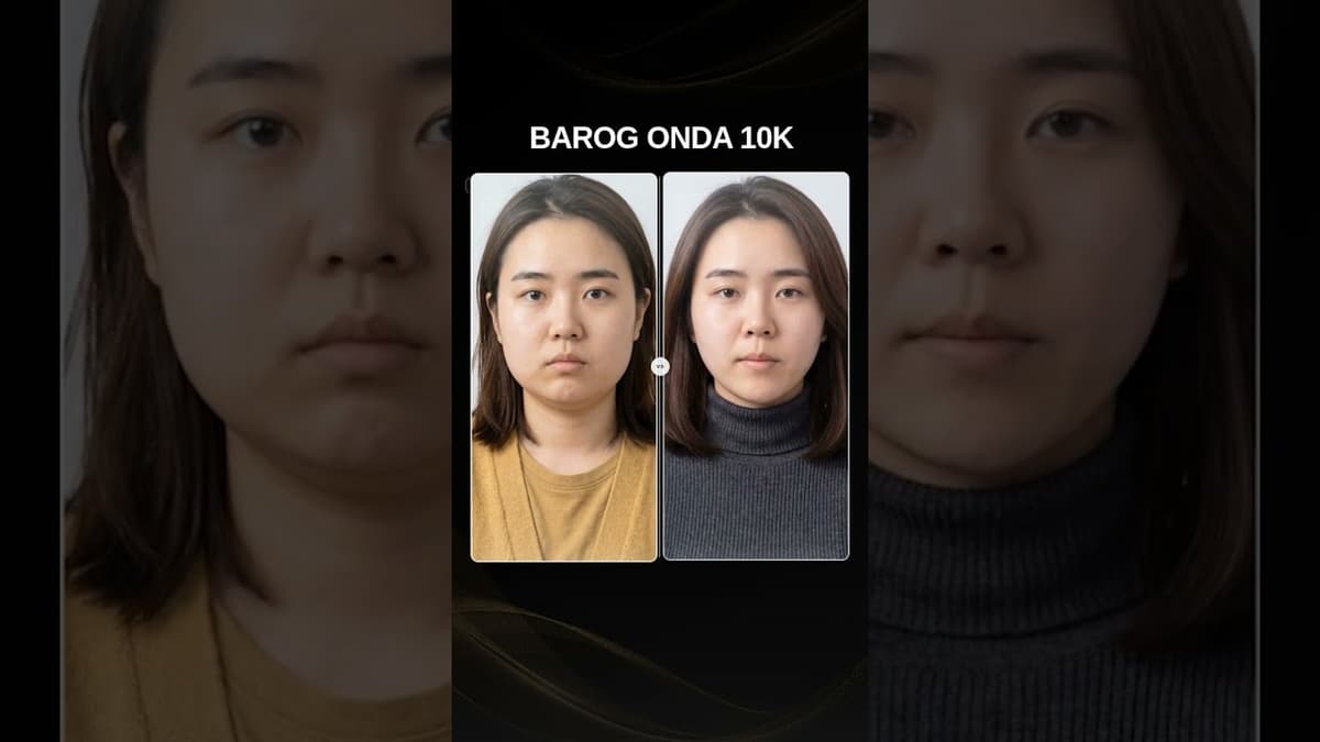 [Gangnam Clinic Seoul: Onda Lifting 10k Before & After✨]