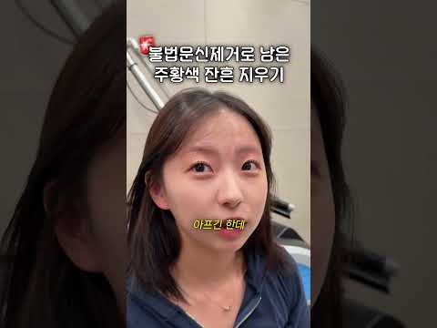 ⚠️문신제거 꼭 병원에서 해야하는 이유⚠️