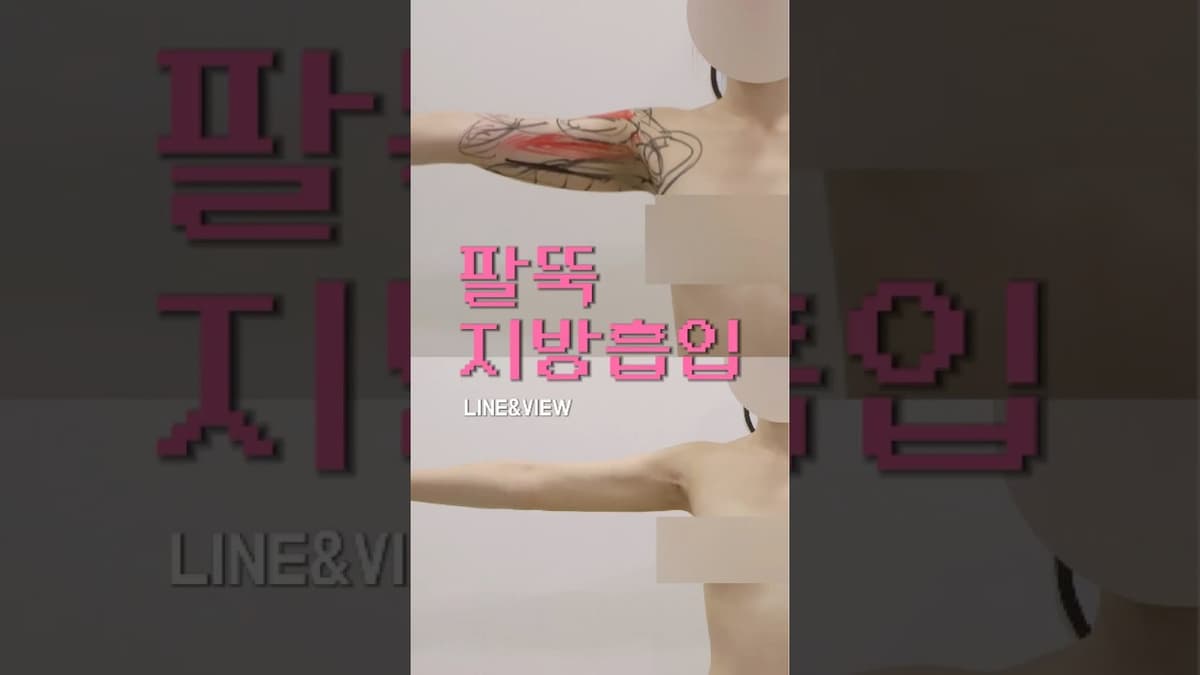 마른데도 팔 지방흡입을 하는 이유｜팔·부유방·뒷볼록