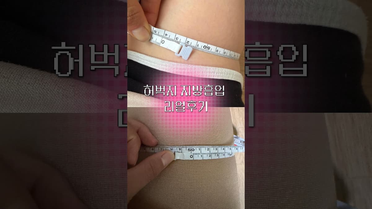 허벅지 지방흡입하면 얼마나 달라질까? 실제 전후 변화