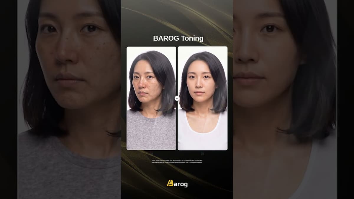 [Gangnam Clinic Seoul: Toning Before & After✨]