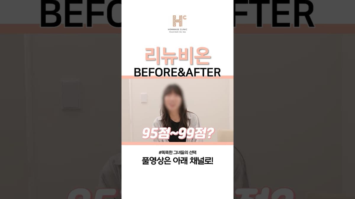 리뉴비온 BEFORE & AFTER #리뉴비온 #리뉴비온2 #시술후기 #수술후기  #다이어트처진살