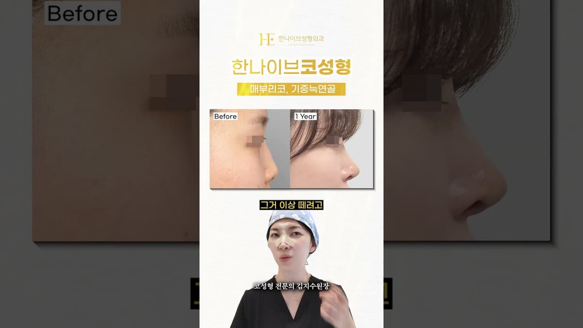 매부리코가 고민?