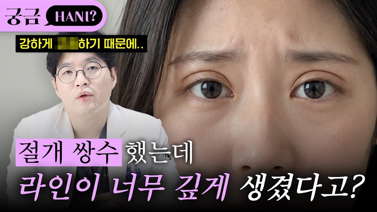 절개쌍수를 했는데 라인이 너무 깊다면?🤔ㅣ진실이 궁금하니?