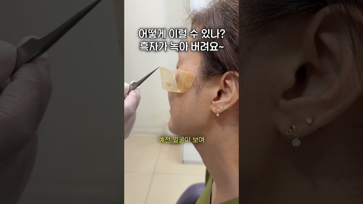 (정확히는 녹는 건 아닙니다🫠)