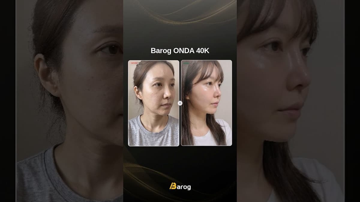 [Gangnam Clinic Seoul: ONDA 40K Before & After✨]