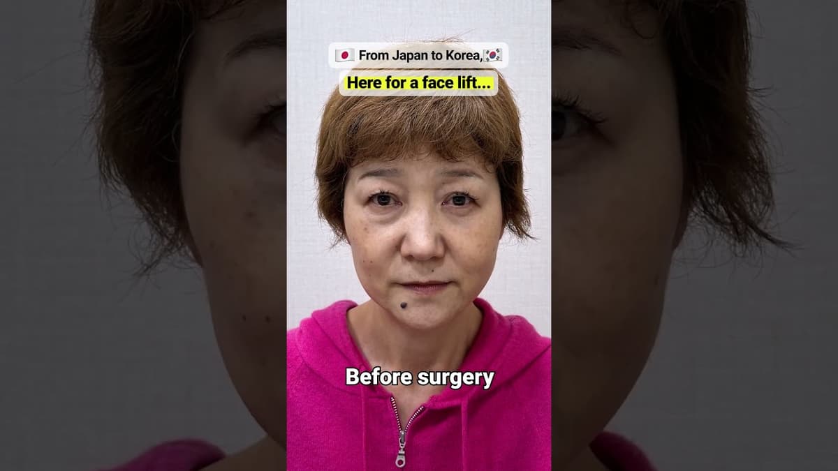 Face Lifting surgery, from Japan?  #viral #korea #beauty #seoul #trend #japanese #japan #facelift