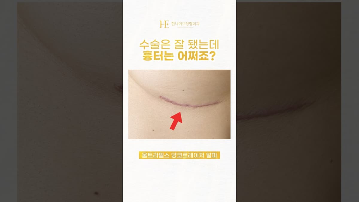 가슴밑선 흉터제거