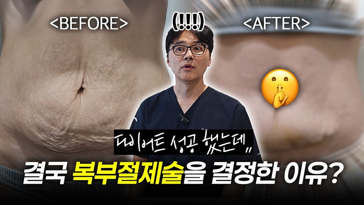 다이어트 성공 했는데.. 결국 복부절제술을 결정하게 된 사연😞 수술 전후 / 수술 후기 공개!  #다이어트 #복부성형