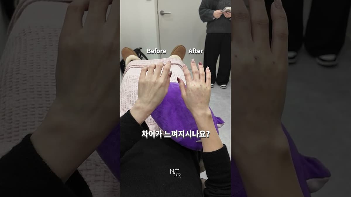 손등 필러 생소하신가요?🤔 손등 필러 개선 케이스