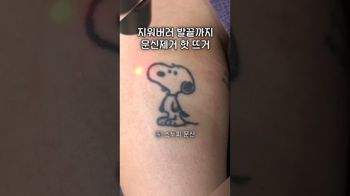 Tatuaje para un nuevo comienzo #eliminaciondetatuaje #ByNMe
