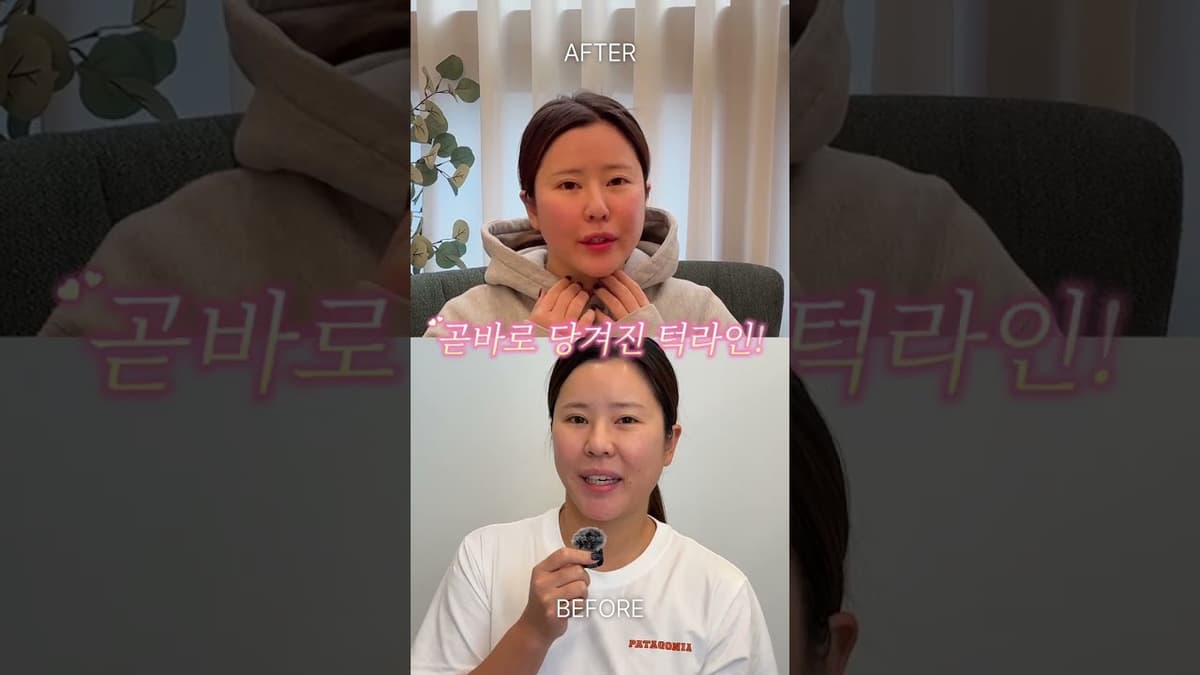30대 턱선 살리는 꿀팁! #티브이리프팅