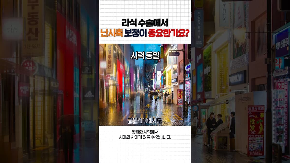 라식 수술 난시교정, 눕는 순간 눈이 돌아갑니다