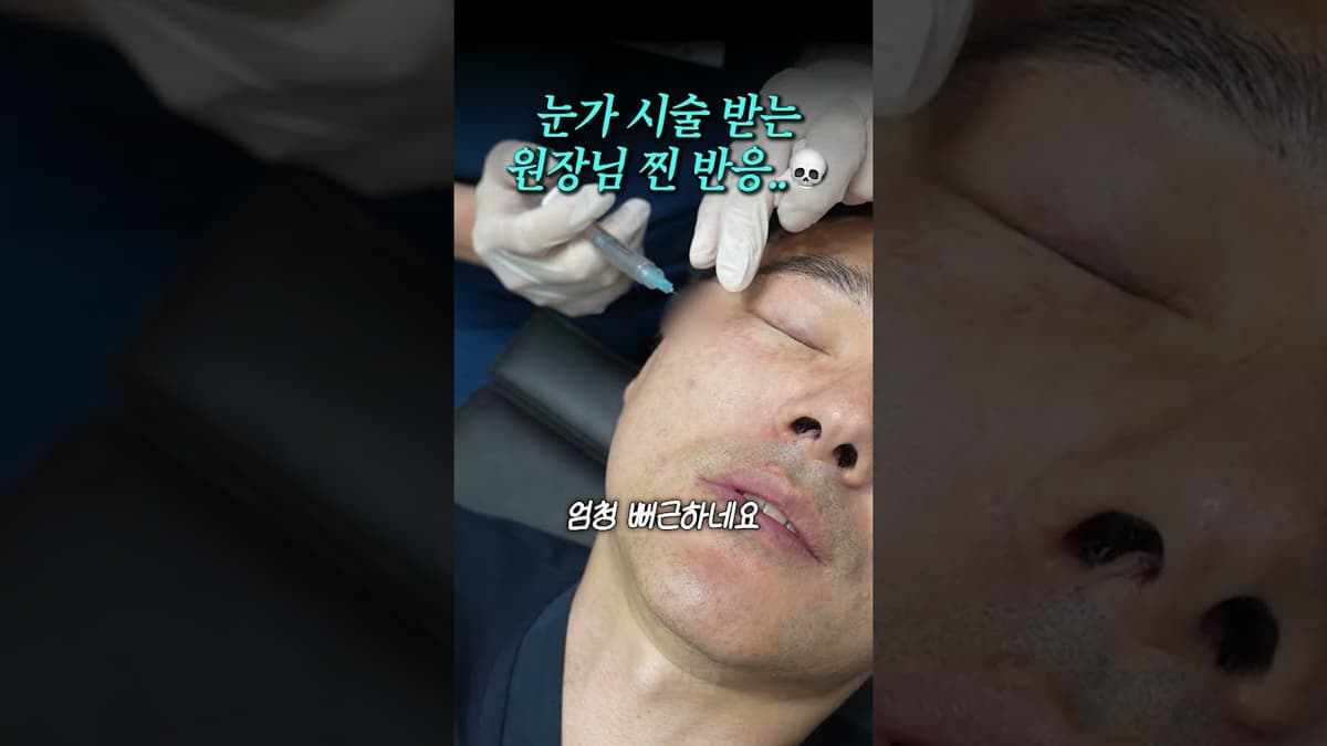 직접 눈가 레티젠 시술 받는 원장님 찐 반응..💀