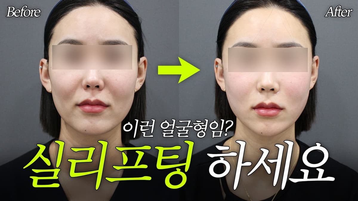 실리프팅이 잘 맞는 얼굴, 땅콩형 초입 l 실터뷰 Ep 1