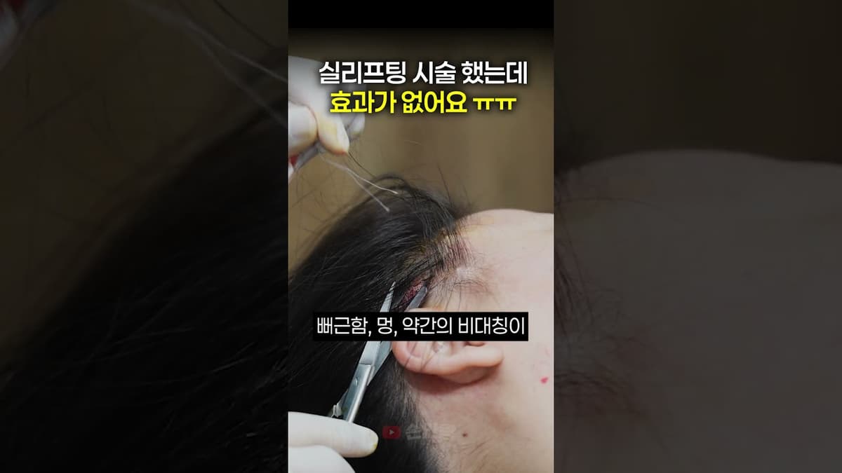실리프팅 시술, 나만 효과 없는 이유