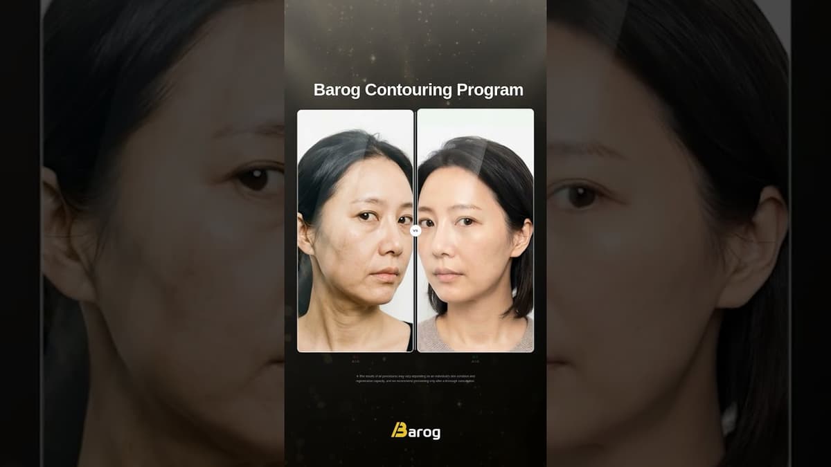 [Gangnam Clinic Seoul: Facial Contouring Program Before & After✨]