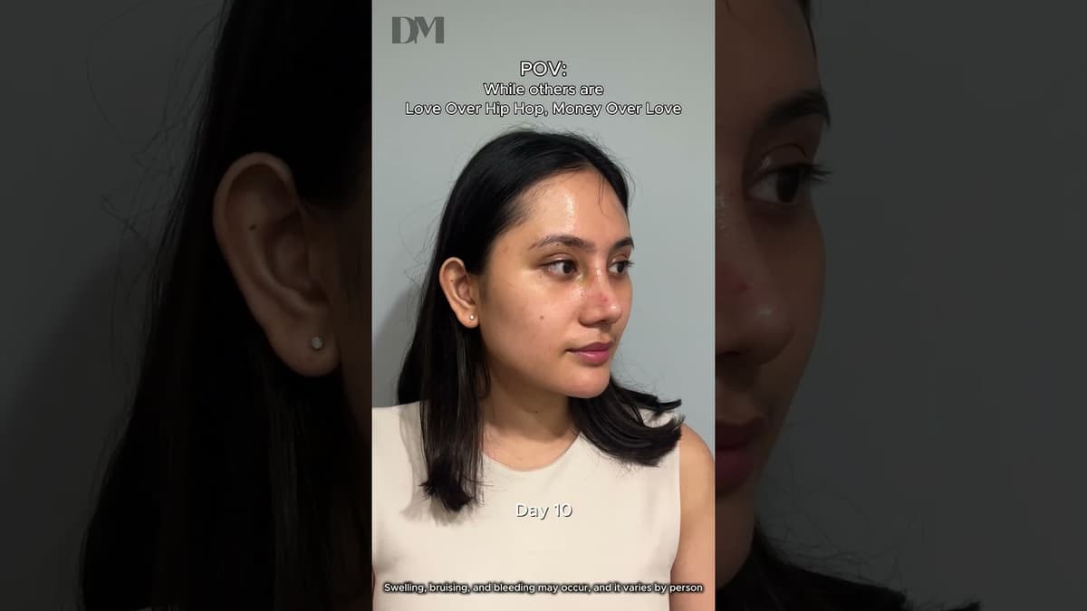 #eyesurgery #rhinoplasty these can look natural?  #viral #korea #beauty #seoul #trend #girls #bts