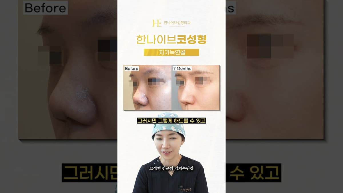 코수술하면 너무 티나요