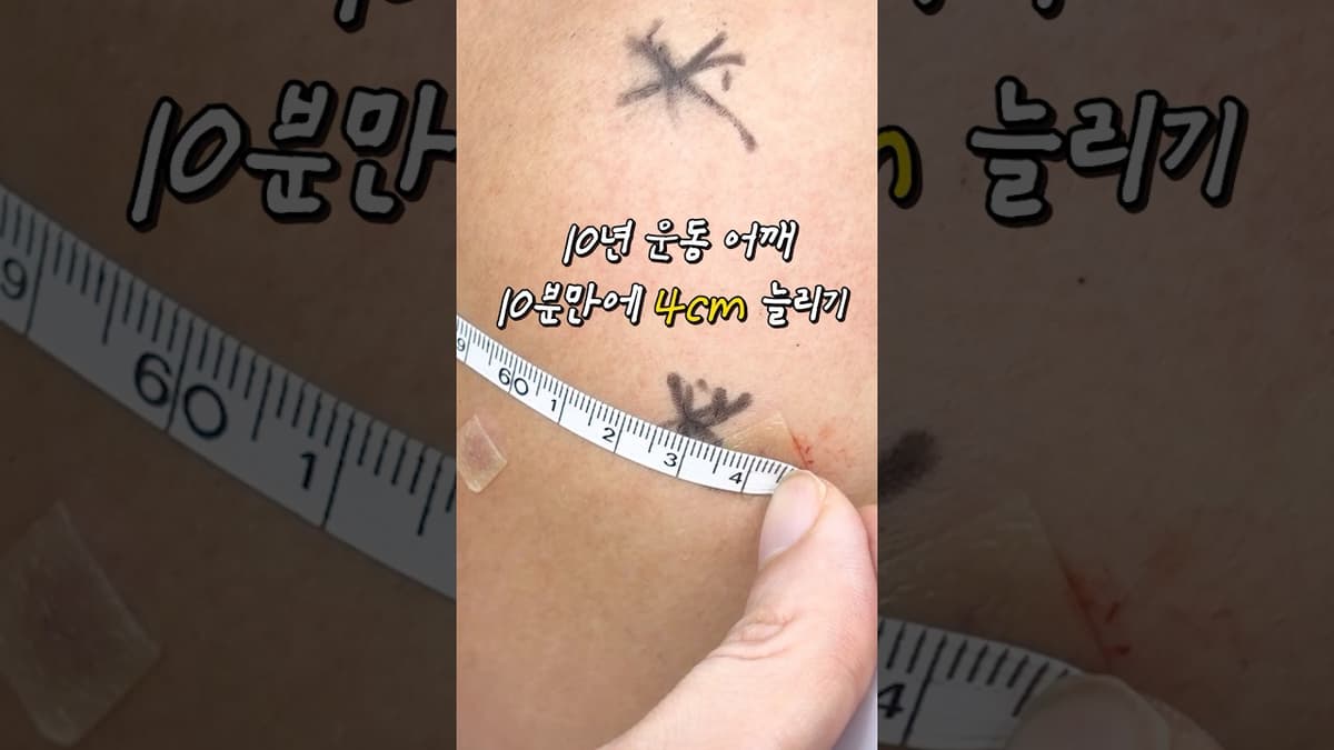 ออกกำลังกาย 10 ปี vs ทำหัตถการ 10 นาที 🤫⁉️
