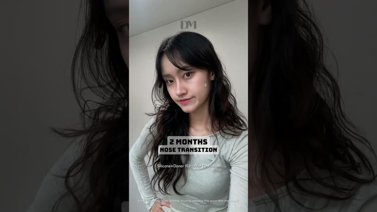 Questa la chiami transizione, tesoro #rinoplasticacorea #seoul #corea #transizione #tendenza #virale #fyp