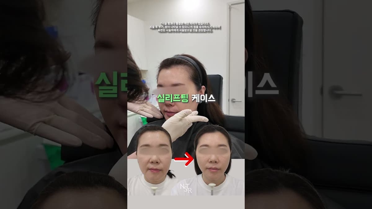 실리프팅 개선