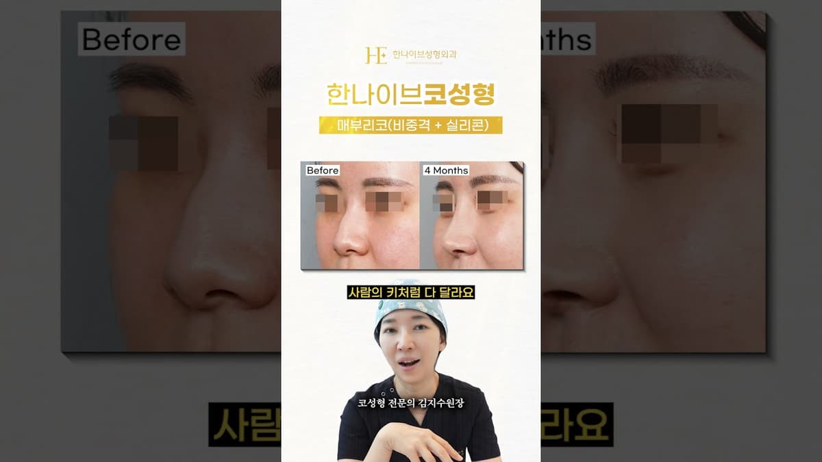 코수술 무조건 화려하게 해주세요