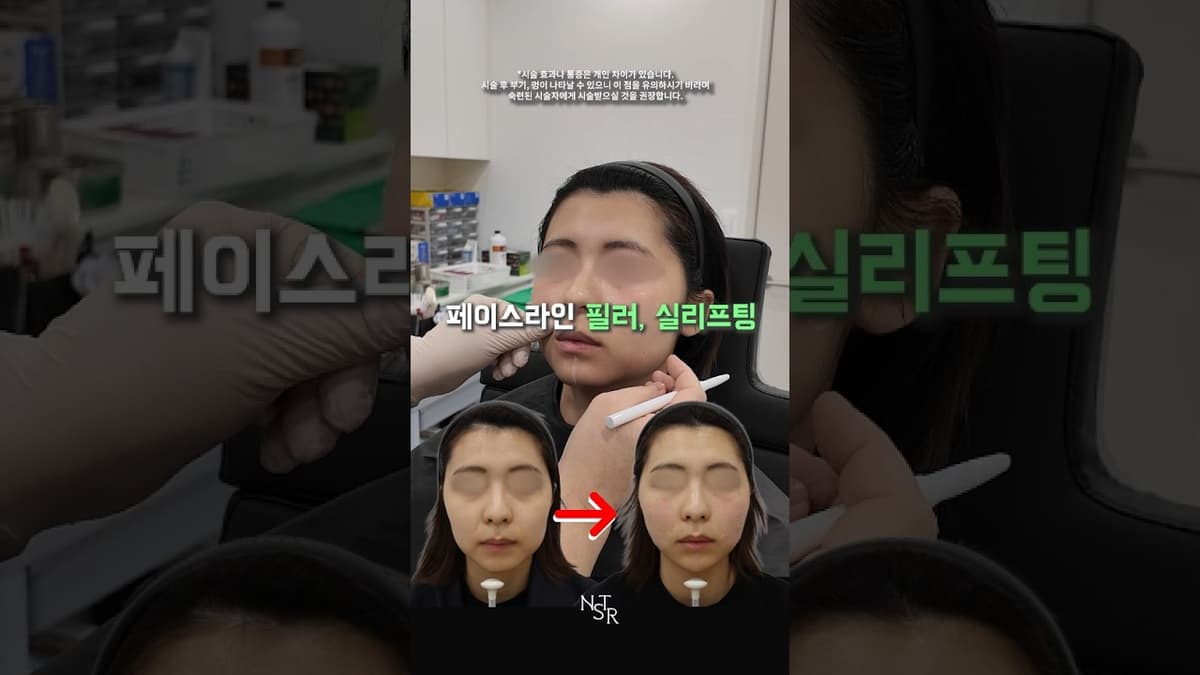 페이스라인 필러 케이스