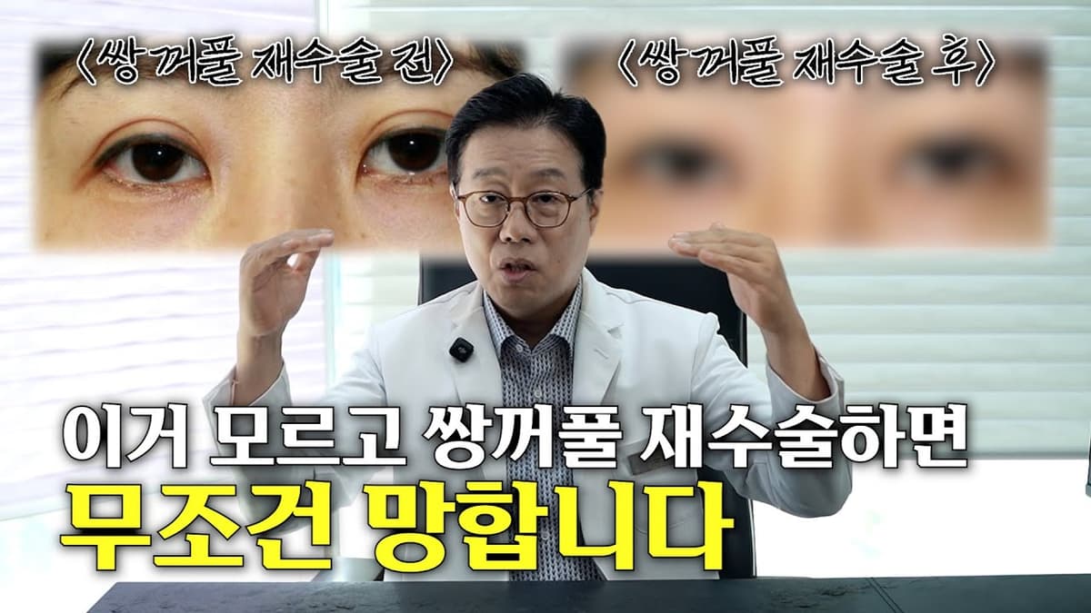 쌍꺼풀 대가가 말하는 재수술 잘하는 방법