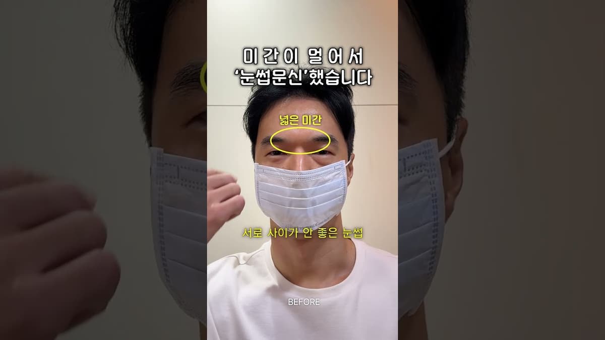 Kening yang tidak sepadan...