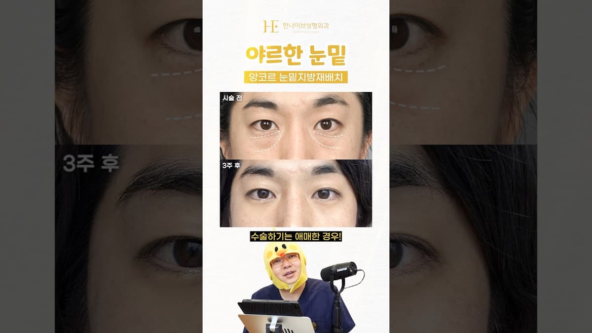 수술하기 애매한 눈밑뽈록