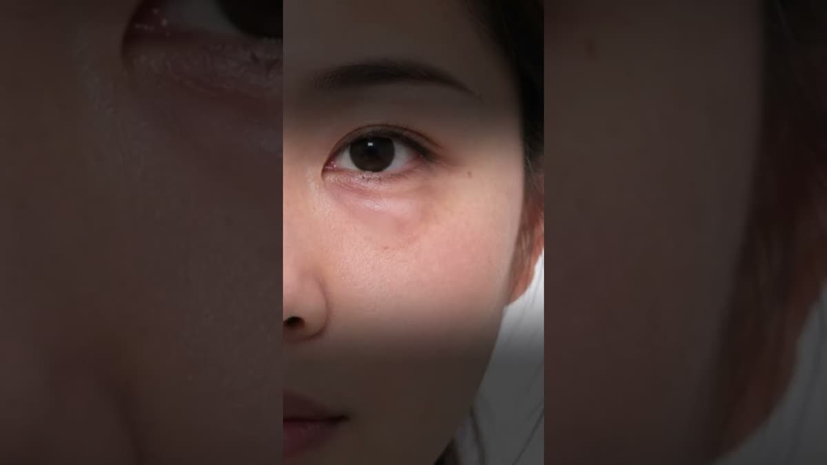 👀눈밑이 볼록 나와있다면⁉️ #shorts #shortvideo #shortsfeed