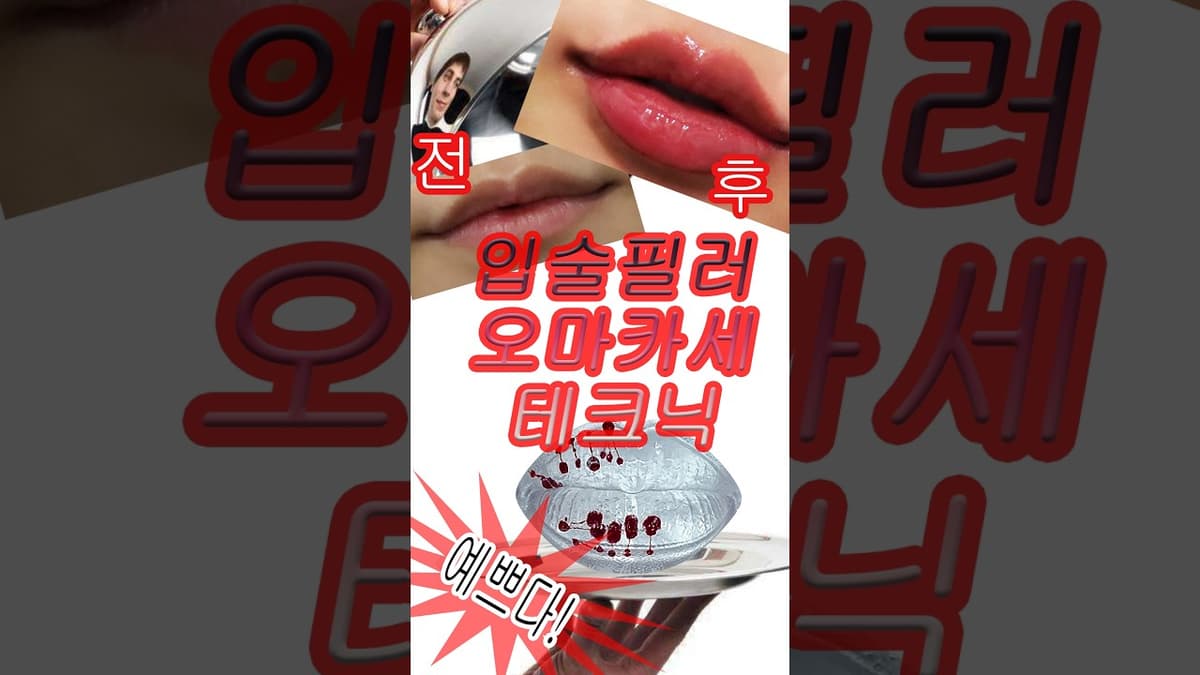 입술필러 오마카세