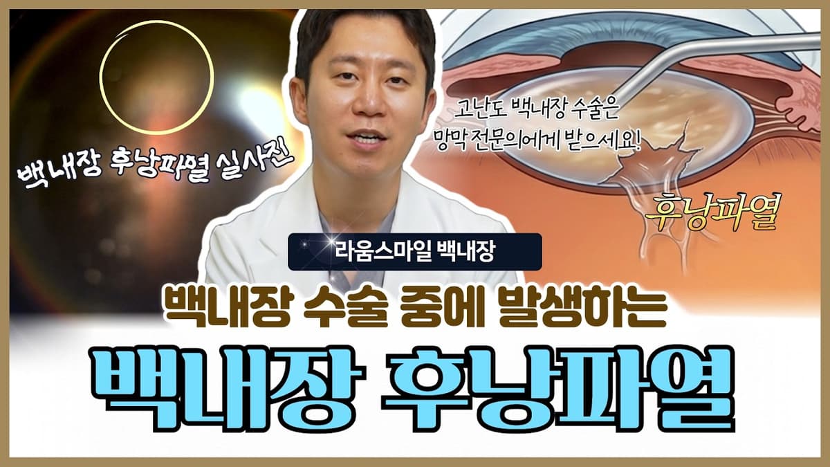 백내장 수술 중 후낭파열, 의사들이 가장 긴장하는 이유