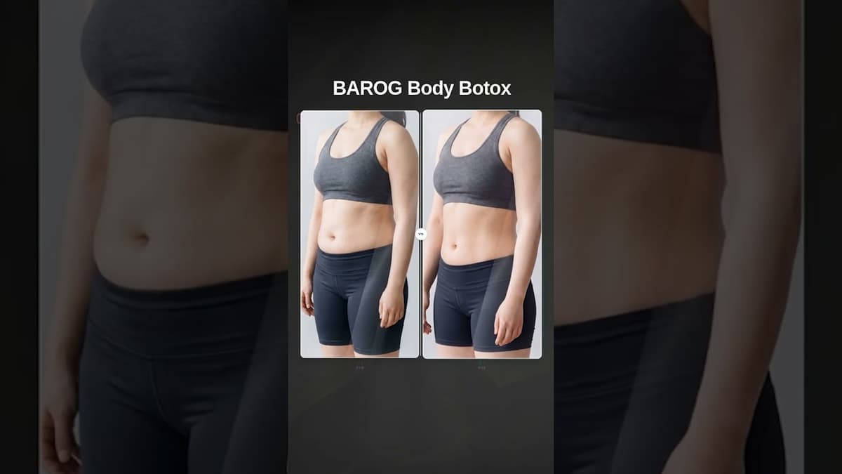 [Gangnam Clinic Seoul: Body Botox Before & After✨]