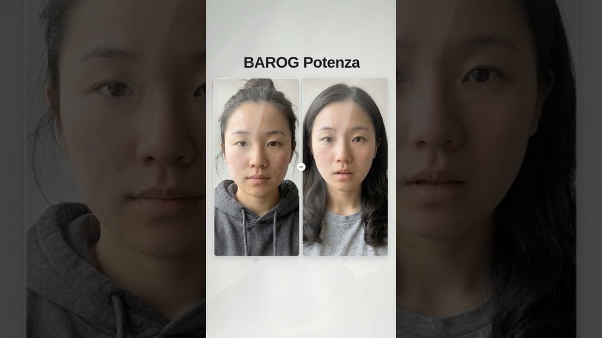 [Gangnam Clinic Seoul: Potenza Before & After✨]