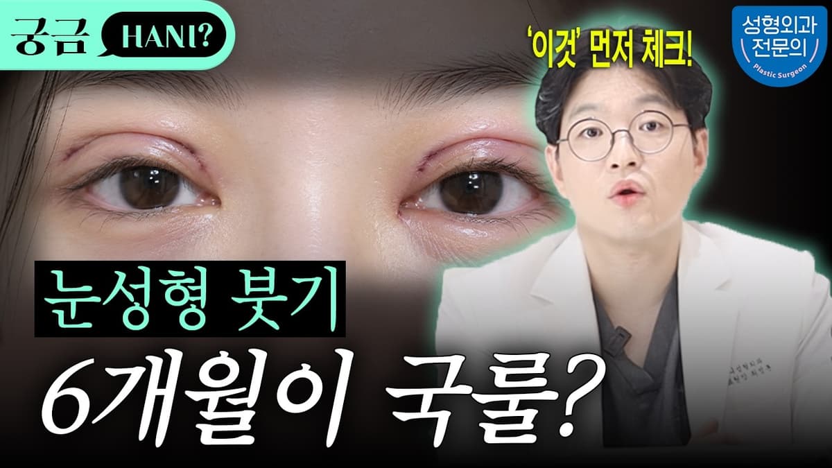 붓기 빠지는데 정말 6개월이나 걸리나요? 😎👀