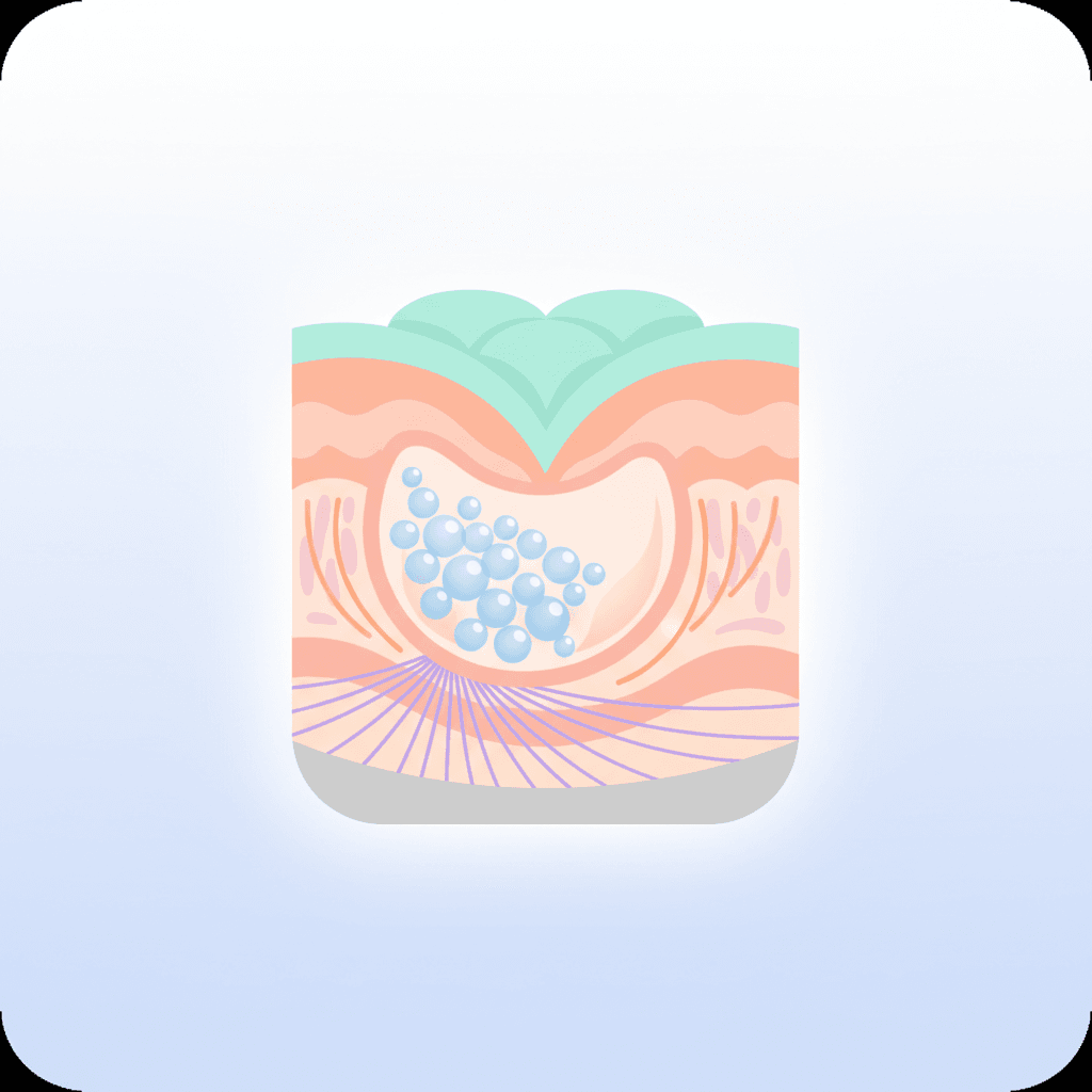 필러 효과, 정확히 얼마나 지속될까? 부위별 지속기간 완전분석