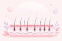 trasplante de cabello