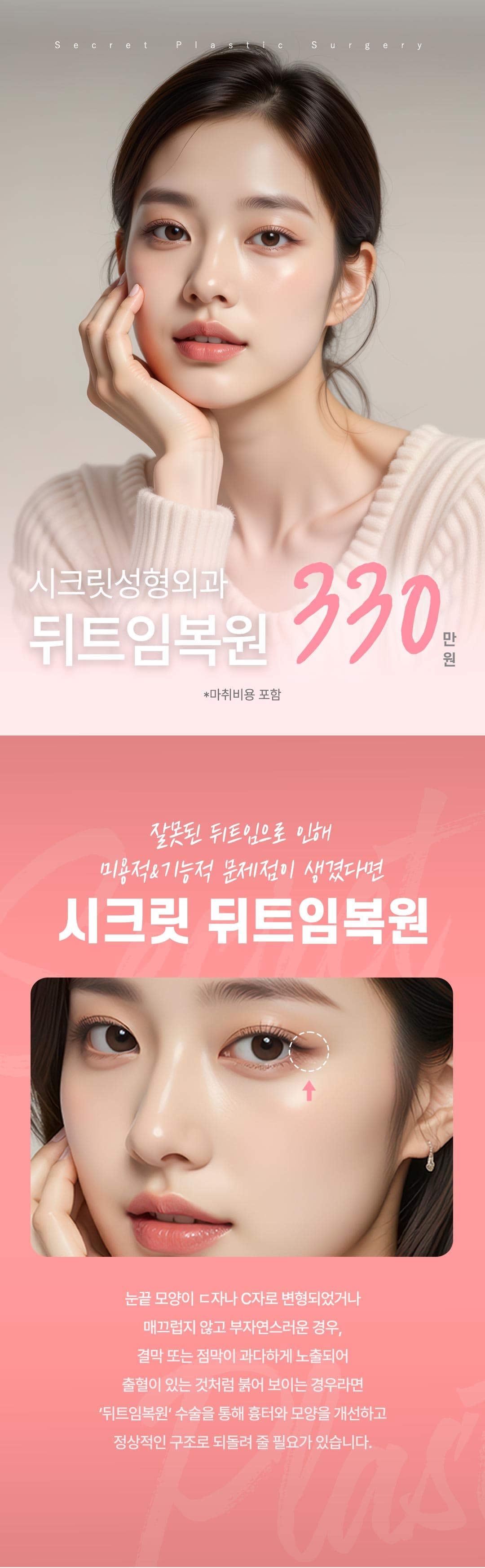 시크릿 뒤트임복원 1